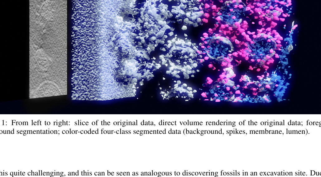 Finding Nano-Ötzi: Cryo-Electron Tomography Visualization Guided by Learned Segmentation