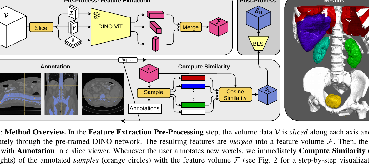 Leveraging Self-Supervised Vision Transformers for Segmentation-based Transfer Function Design